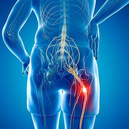 Numbness and tingling in the legs or feet