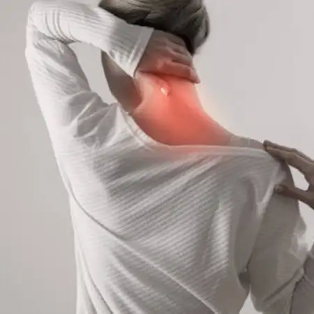 cervical radiculopathy (pinched nerves)