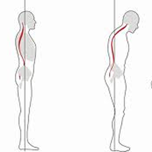 Maintain proper posture to reduce stress on your joints